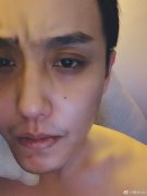 赵泳鑫为什么说自己没办法结婚，原来他曾经被劈腿绿过！