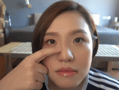 谢依霖整容前后对比图，主要动过鼻子、抽过脂