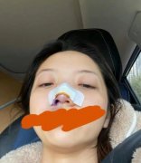 张兆艺老公个人资料，她老公年龄多大？