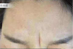 悬针纹有什么不好？悬针纹真的那么可怕吗