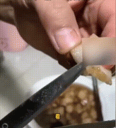 猪肉绦虫能高温杀死吗？猪肉绦虫寄生在猪的什么部位