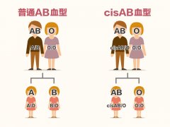 cisAB血型是什么意思？cisAB血型怎么鉴定