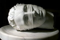 谱系自闭症是什么意思？能治愈康复吗