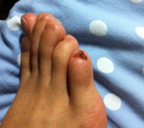 小脚趾甲两瓣是哪族人？传说两种来历