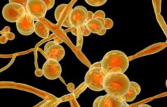 耳念珠菌为什么叫超级真菌？耳念珠菌传染途径、易感人群介绍