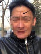 悬针纹怎么去除？悬针纹有什么办法可以去掉