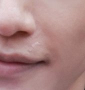 罗云熙为什么暴瘦，瘦到皮包骨原因分析