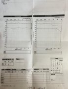 长期戴耳机有什么危害，会影响听力吗？看网友反馈的案例吧！