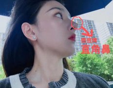 直角鼻子图片，宋祖儿就是典型的直角鼻