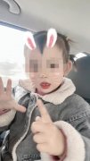 宝宝出生就长牙有牙齿是怎么回事，原来这叫诞生牙最好拔掉