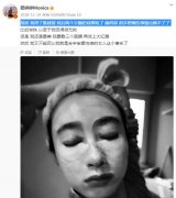 穆婷婷为什么退出演艺圈？她并没有退出，只是受伤严重