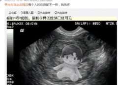每个人的体质都不一样是什么意思？