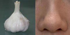 真实的蒜头鼻是什么样子的，图片来了，跟蒜一模一样！