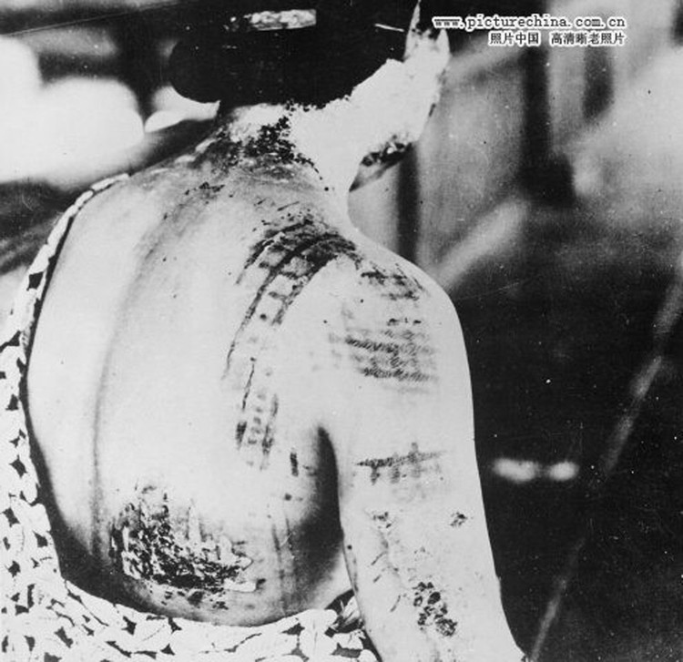 1945年广岛遭原子弹爆炸后惨状 - 刘鹏 - 凝固的历史—永恒的回忆