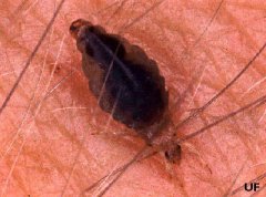 虱子长什么样放大图片，虱子是怎么产生的？