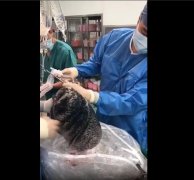 戒烟一年了肺部变化图片，30年烟龄的肺会被熏成什么样？