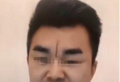 悬针纹是身体哪里出了问题吗，怎么化解和消除？