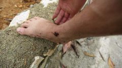 蚂蟥会钻进人的身体里吗？看这个小男孩的案例你就知道了！