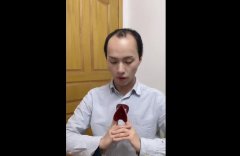 楚淇为什么秃顶了？他微博是多少？年龄多大？为什么不植发