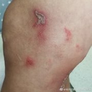 隐翅虫分布在哪里？隐翅虫翅膀展开折叠动图