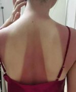 老婆后背晒印是什么梗？老婆出差晒的印子有什么内涵
