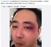 被媳妇家暴怎么办，被媳妇挠伤后怎么处理？
