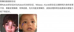 歌舞伎综合症患儿寿命，成年后会怎么样了？