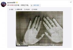 复印机复印脸有危害吗？复印机有没有辐射
