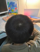 小孩头上的旋在正中间好吗，头旋怎么能去掉？