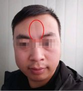 天柱纹好不好？天柱纹男人的面相图片