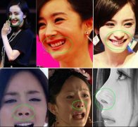 杨幂鼻子和嘴巴很丑吗？杨幂为什么叫沁沁