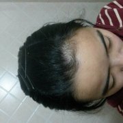 额头长旋的位置图解，额头上有旋的女孩好吗？