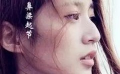 面相学中鼻子有节的女人婚姻不好克夫？鼻梁有节突出的女人照片