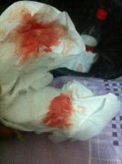 男生看到女生月经血会倒霉吗，不小心碰到女人月经血会倒霉多久？