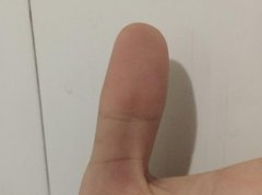 佛眼纹不闭合图片，佛眼纹不闭合会怎么样？